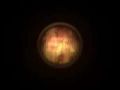 Dead Space - Nana